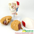 SKULL11-1 (12337-1) Skull with Brain, Medical Science Anatomy Cranial Nerve Plastic Skull Brain Models